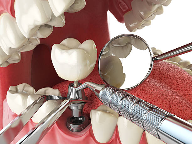 Best Dental Abscess Treatment in Jarrettsville, MD